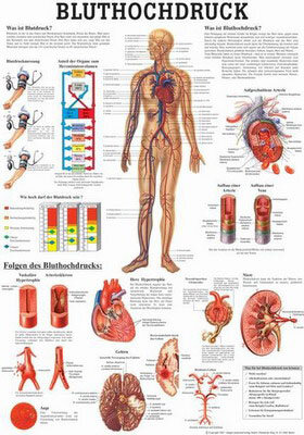 Anatomie Poster: Bluthochdruck