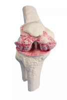 Anatomiemodell Knieimplantat